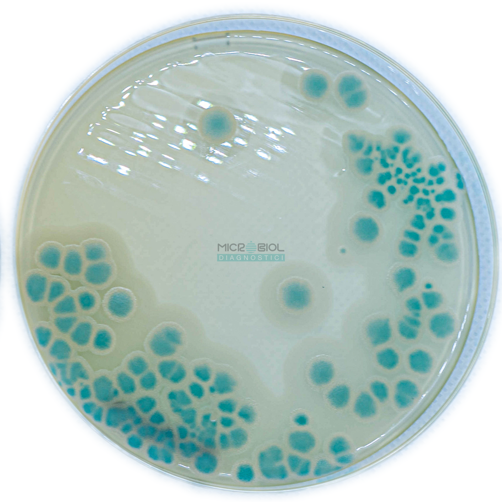 BACILLUS CEREUS CHROMOGENIC AGAR