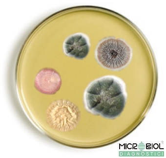 SABOURAUD MALTOSE AGAR