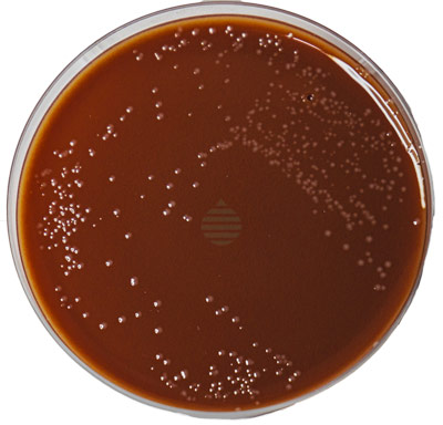 TAYLORELLA EQUIGENITALIS AGAR BASE (C.E.M.O.)